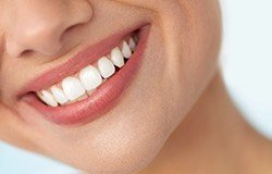 Dental Tooth Bonding  Cosmetic Dentist Orange Woodbridge Milford